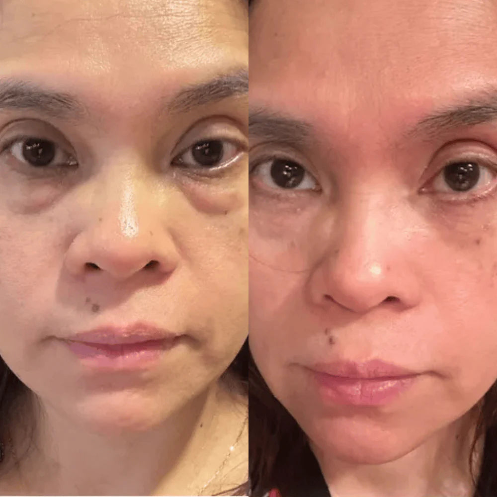 Bálsamo Facial Antiedad Hidratante
