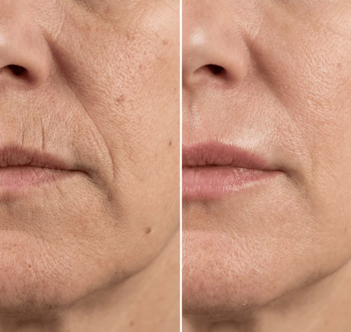 Bálsamo Facial Antiedad Hidratante