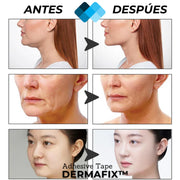 (PACK 120 Unidades) Tiras de Lifting facial efecto Natural "Buena Cara" l BeautySide™ 5